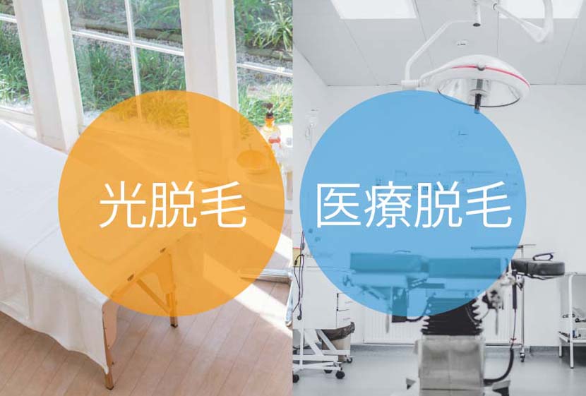光脱毛か医療脱毛か