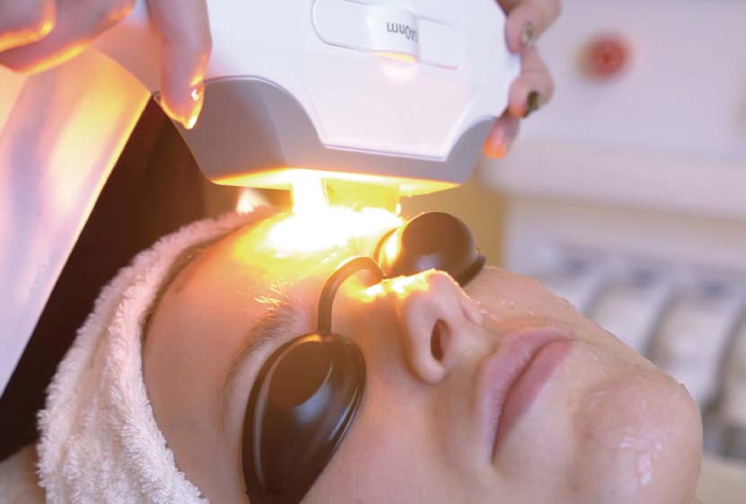 ニキビ跡-ペガサスプロのEライト